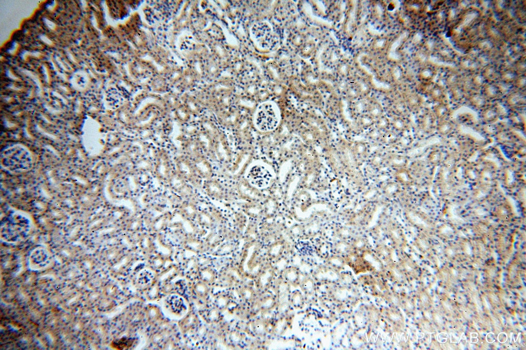 Immunohistochemistry (IHC) staining of mouse kidney tissue using ACOT9 Polyclonal antibody (15901-1-AP)