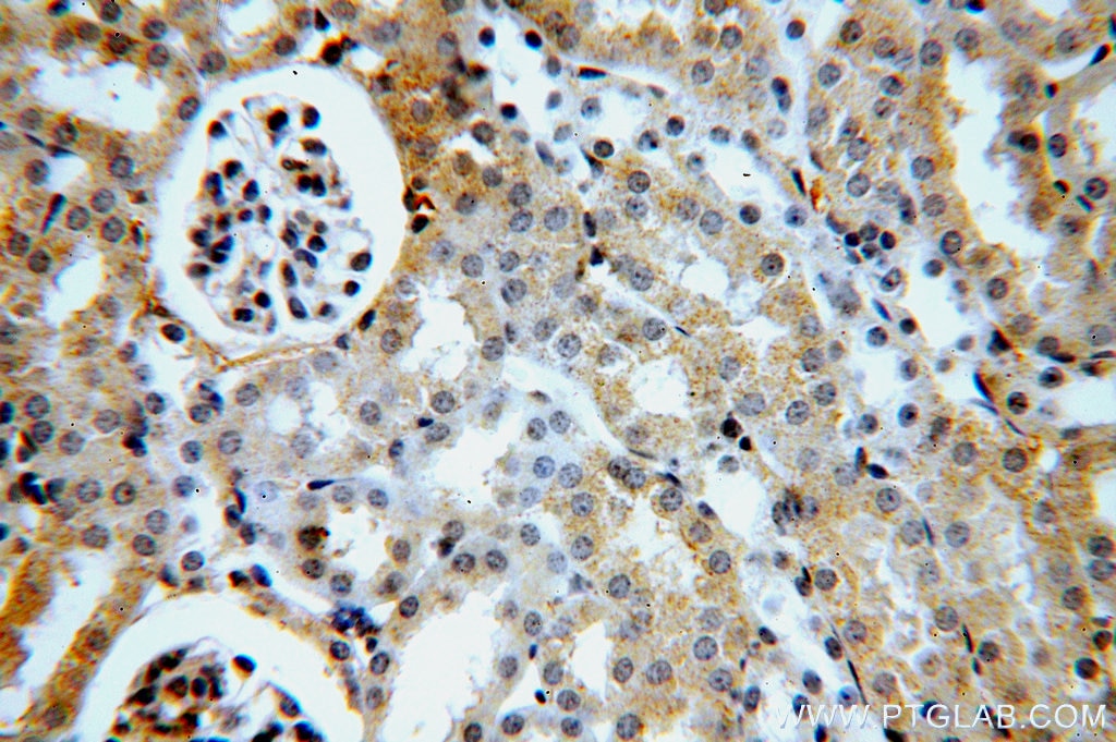 Immunohistochemistry (IHC) staining of mouse kidney tissue using ACOT9 Polyclonal antibody (15901-1-AP)
