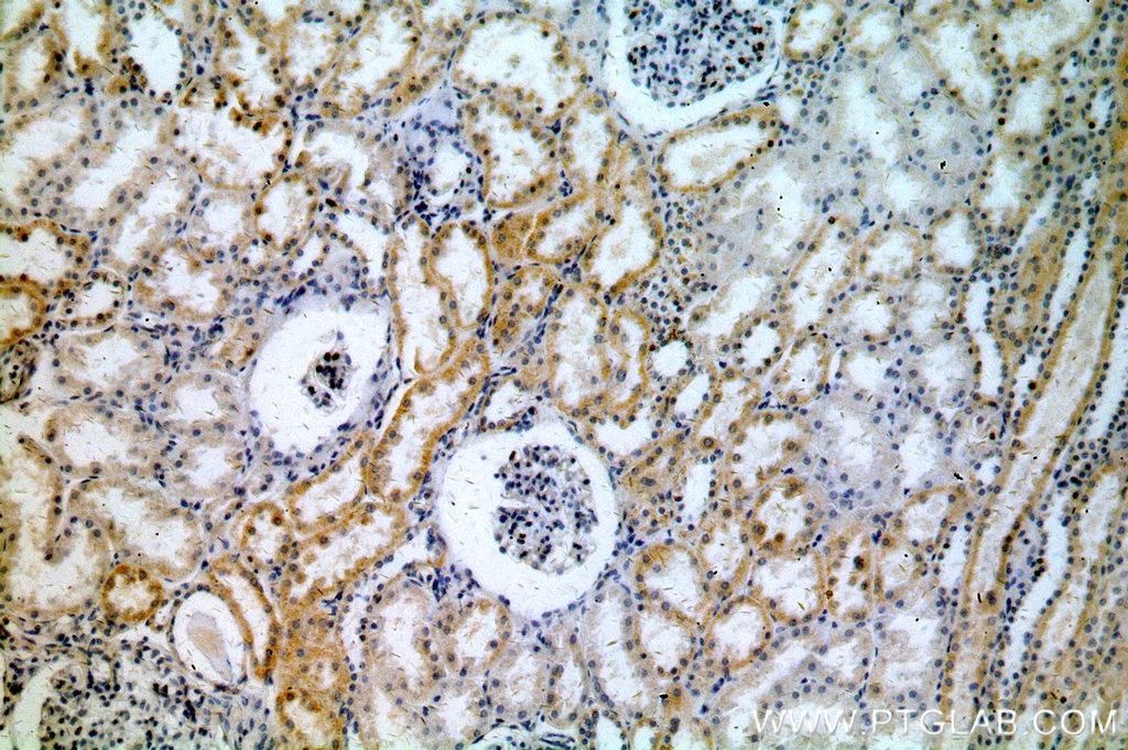 IHC staining of human kidney using 15901-1-AP