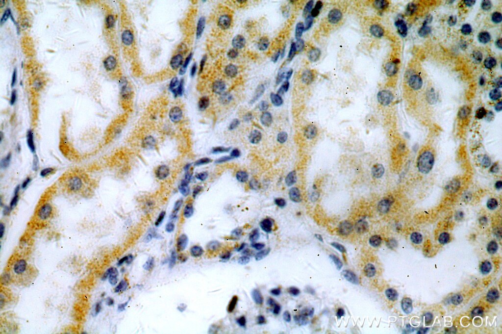 Immunohistochemistry (IHC) staining of human kidney tissue using ACOT9 Polyclonal antibody (15901-1-AP)