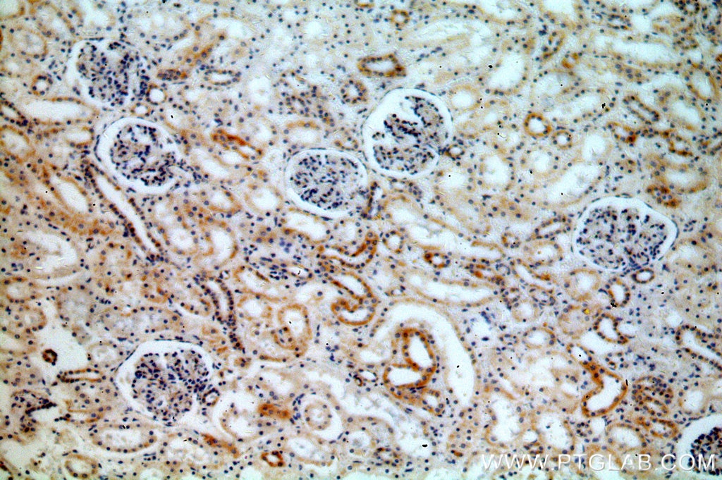 Immunohistochemistry (IHC) staining of human kidney tissue using ACOT9 Polyclonal antibody (15901-1-AP)
