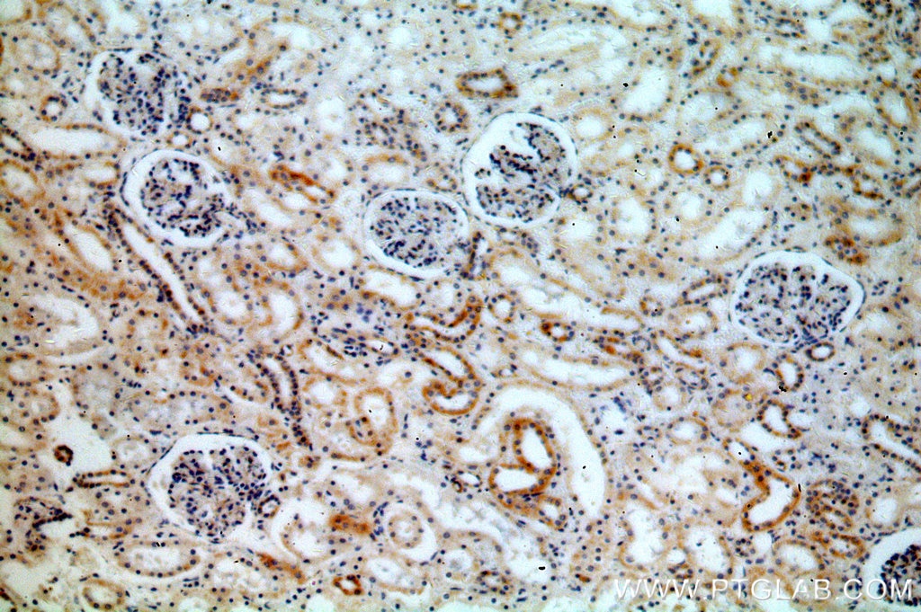 IHC staining of human kidney using 15901-1-AP