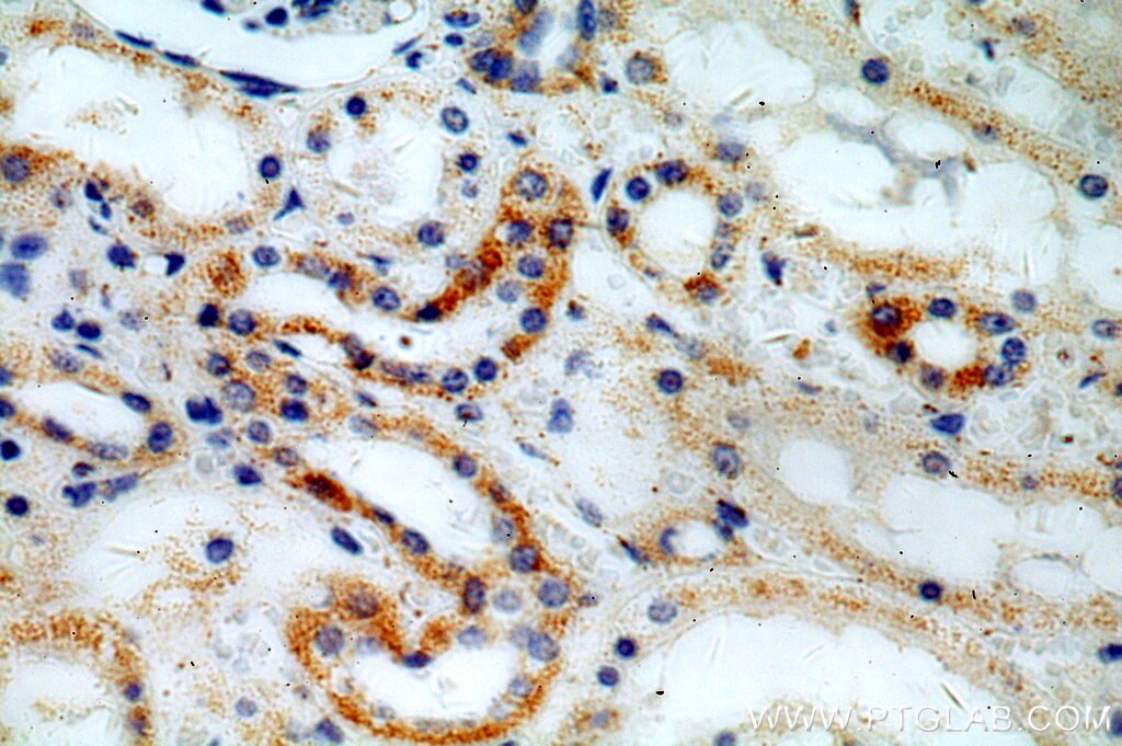 Immunohistochemistry (IHC) staining of human kidney tissue using ACOT9 Polyclonal antibody (15901-1-AP)