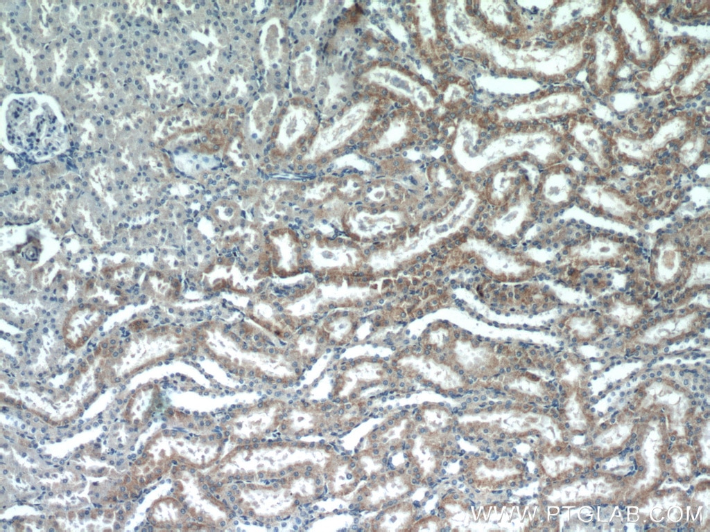 Immunohistochemistry (IHC) staining of rat kidney tissue using ACOT9 Polyclonal antibody (15901-1-AP)