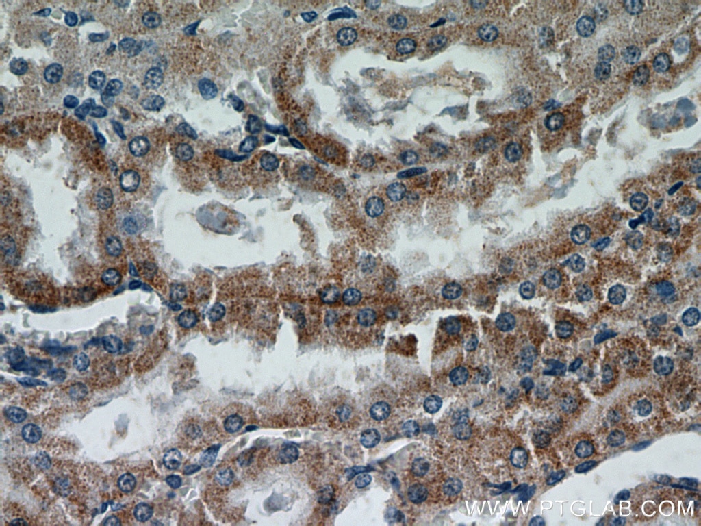 Immunohistochemistry (IHC) staining of rat kidney tissue using ACOT9 Polyclonal antibody (15901-1-AP)