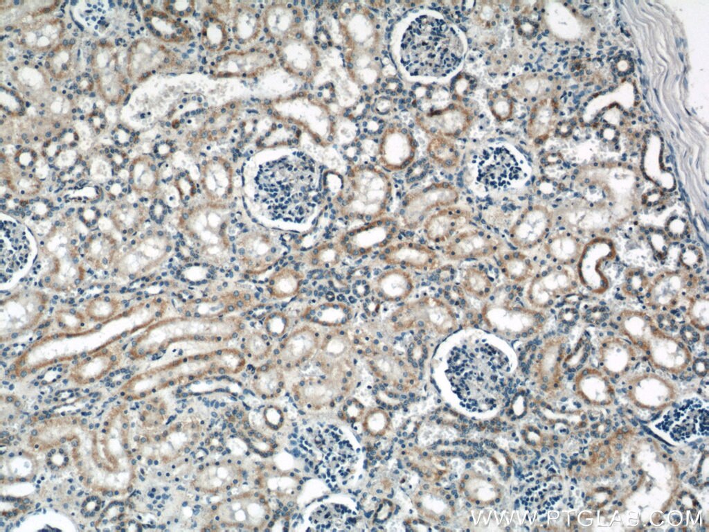 Immunohistochemistry (IHC) staining of human kidney tissue using ACOT9 Polyclonal antibody (15901-1-AP)