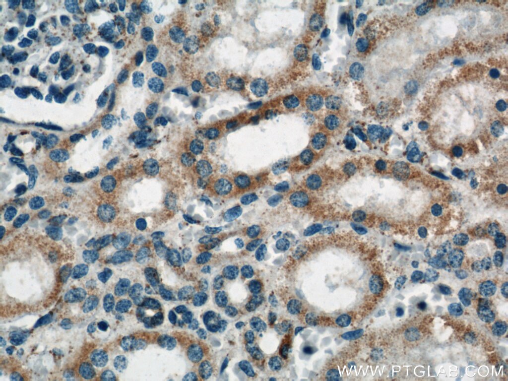 Immunohistochemistry (IHC) staining of human kidney tissue using ACOT9 Polyclonal antibody (15901-1-AP)