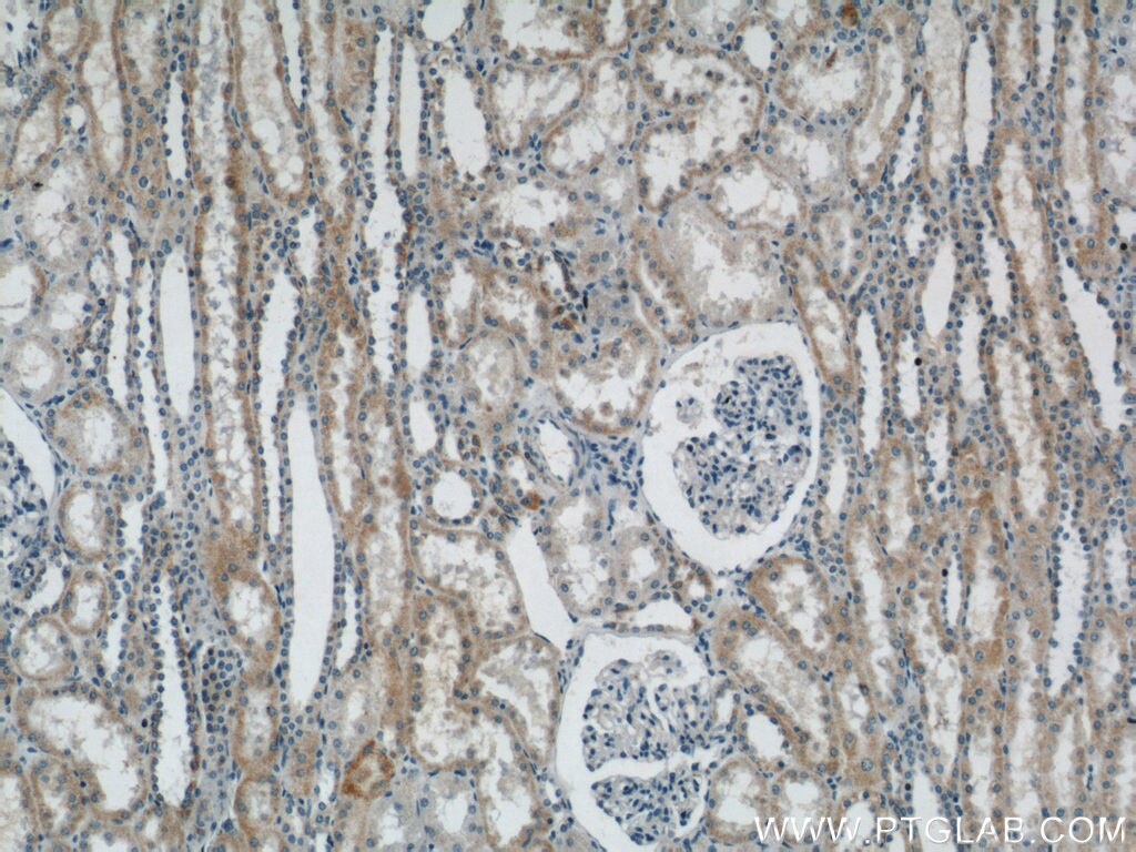 Immunohistochemistry (IHC) staining of human kidney tissue using ACOT9 Polyclonal antibody (15901-1-AP)