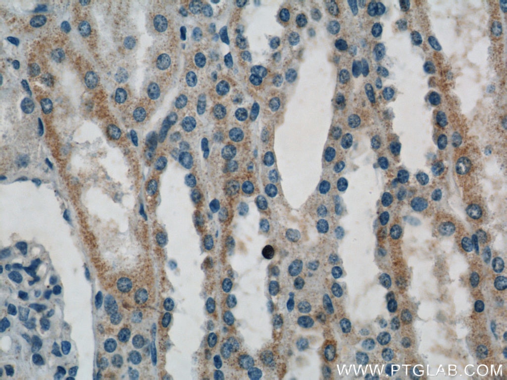 Immunohistochemistry (IHC) staining of human kidney tissue using ACOT9 Polyclonal antibody (15901-1-AP)