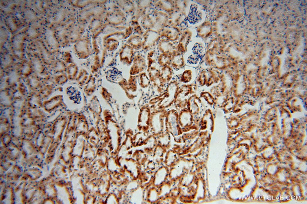 Immunohistochemistry (IHC) staining of human kidney tissue using ACOT9 Polyclonal antibody (15901-1-AP)