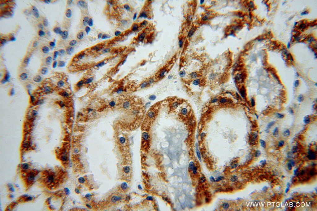 Immunohistochemistry (IHC) staining of human kidney tissue using ACOT9 Polyclonal antibody (15901-1-AP)