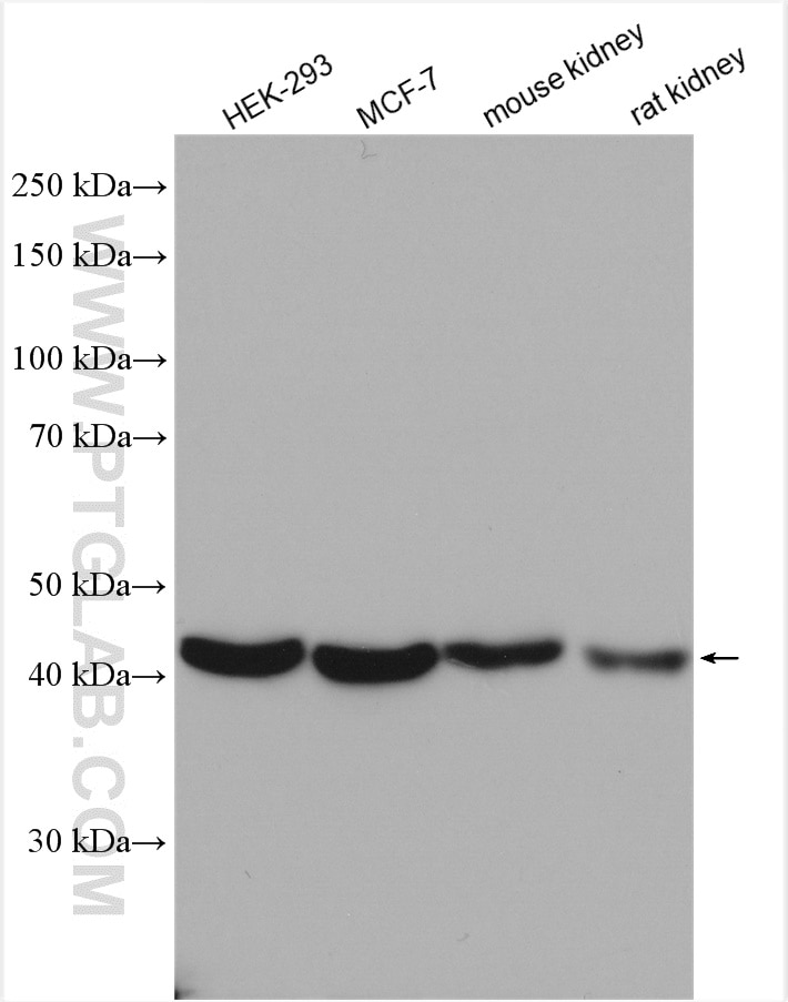 Western Blot (WB) analysis of various lysates using ACOT9 Polyclonal antibody (15901-1-AP)