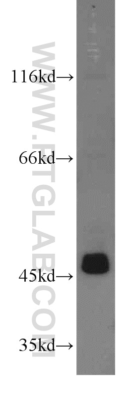 Western Blot (WB) analysis of MCF-7 cells using ACOT9 Polyclonal antibody (15901-1-AP)