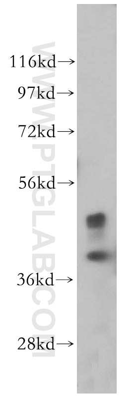 Western Blot (WB) analysis of MCF-7 cells using ACOT9 Polyclonal antibody (15901-1-AP)