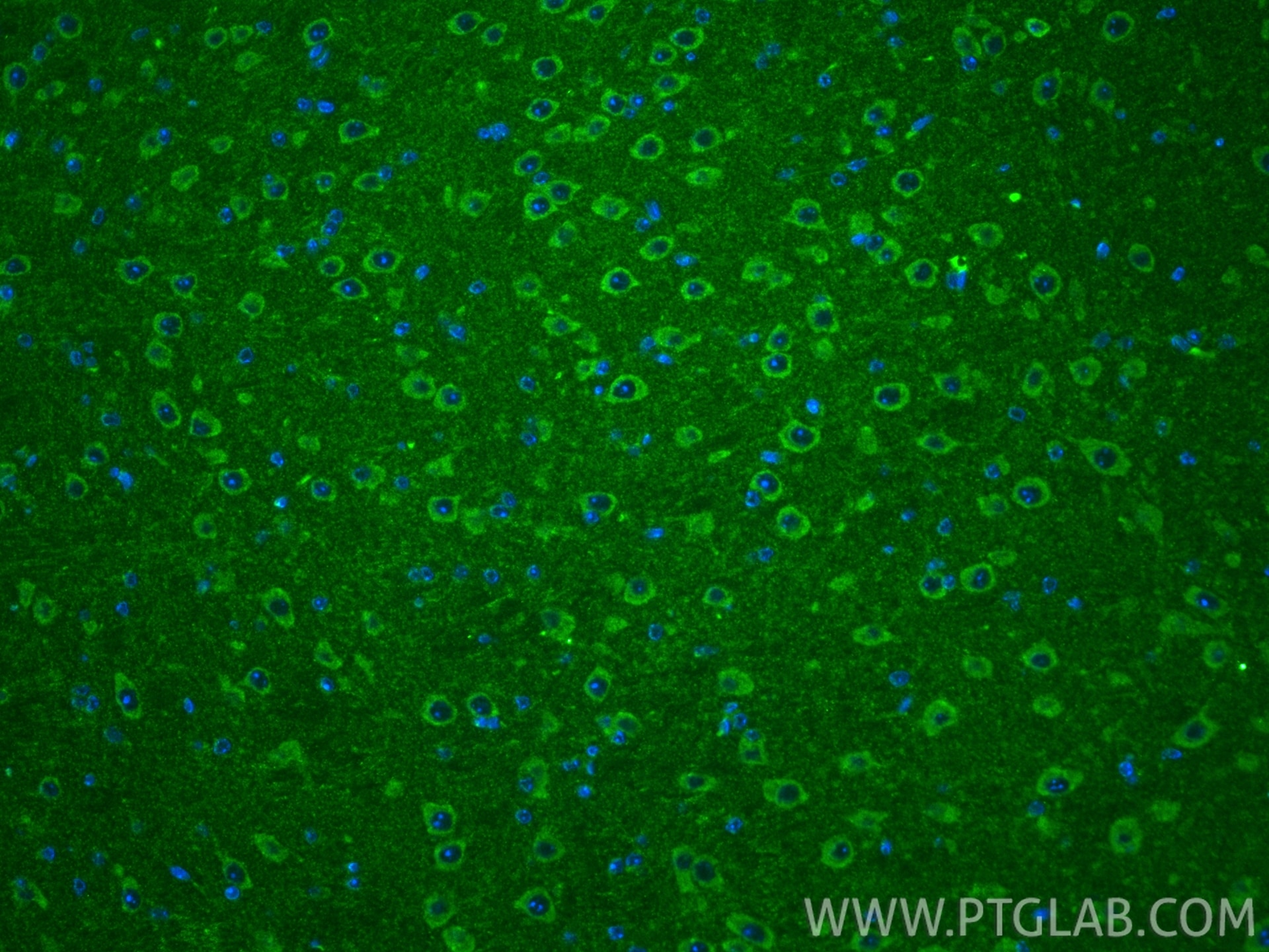 IF Staining of mouse brain using 66532-1-Ig Immunofluorescence (IF) / fluorescent staining of mouse brain tissue using ACOT9 Monoclonal antibody (66532-1-Ig)