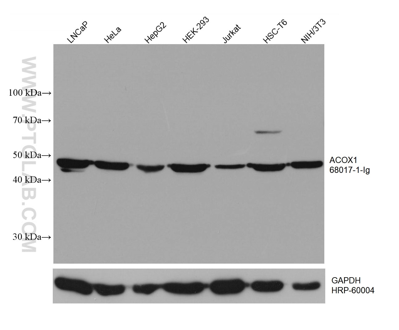 Western Blot (WB) analysis of LNCaP cells using ACOX1 Monoclonal antibody (68017-1-Ig)