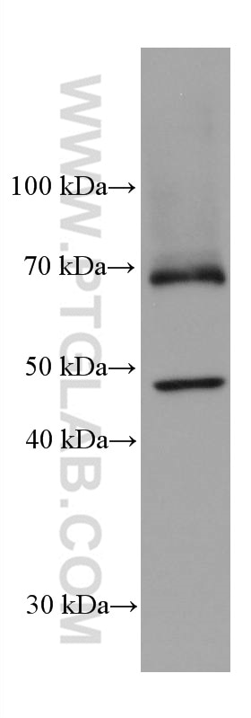 WB analysis of rat liver using 68017-1-Ig