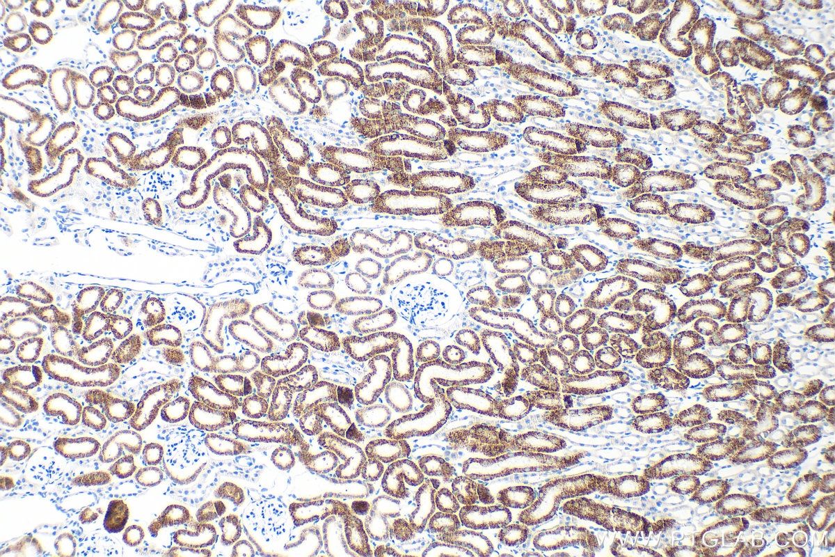 Immunohistochemistry (IHC) staining of mouse kidney tissue using ACOX1 Recombinant monoclonal antibody (83731-1-RR)