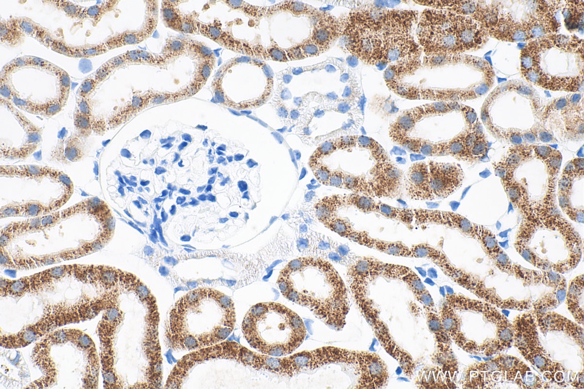 Immunohistochemistry (IHC) staining of mouse kidney tissue using ACOX1 Recombinant monoclonal antibody (83731-1-RR)