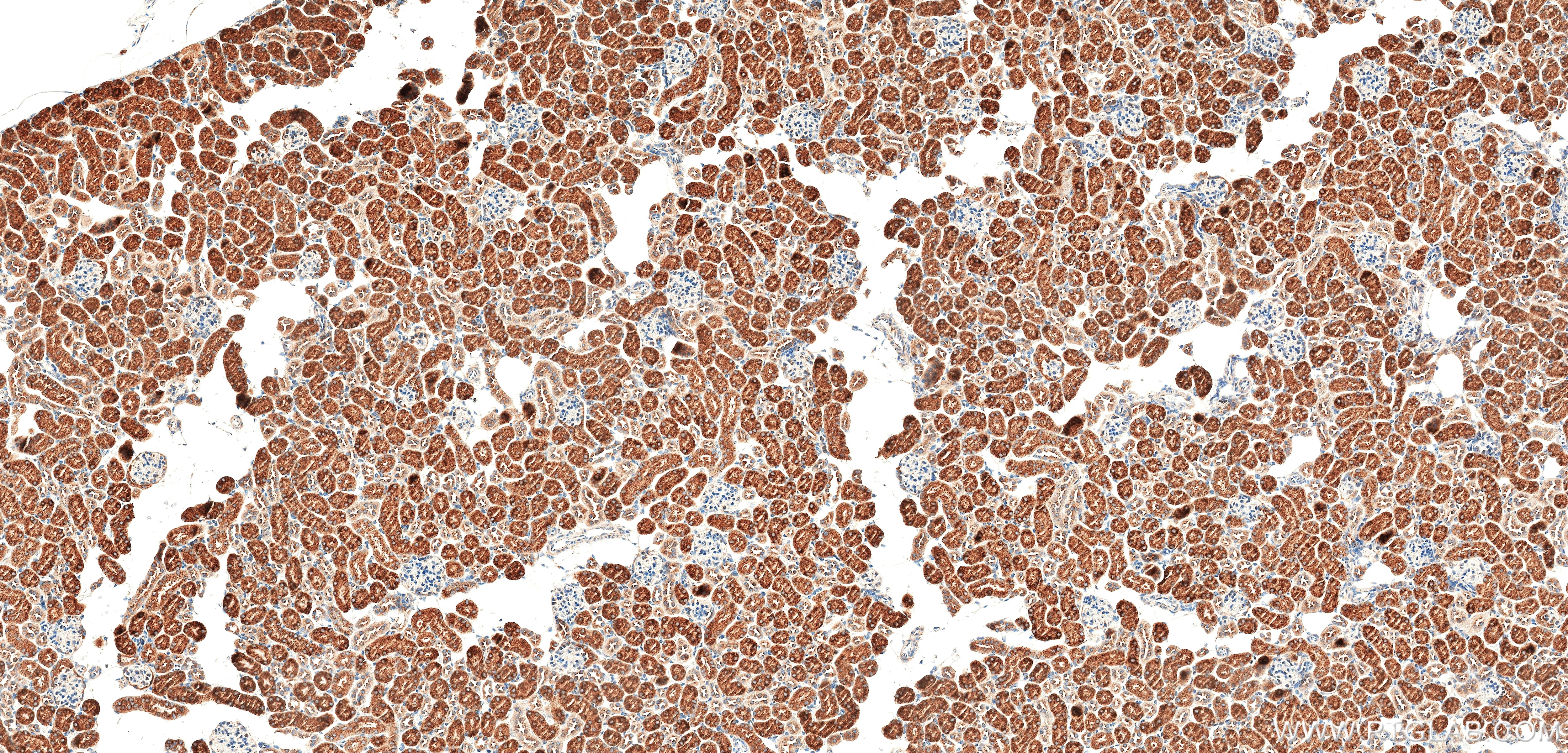 Immunohistochemistry (IHC) staining of mouse kidney tissue using ACOX1 Recombinant monoclonal antibody (83731-2-RR)