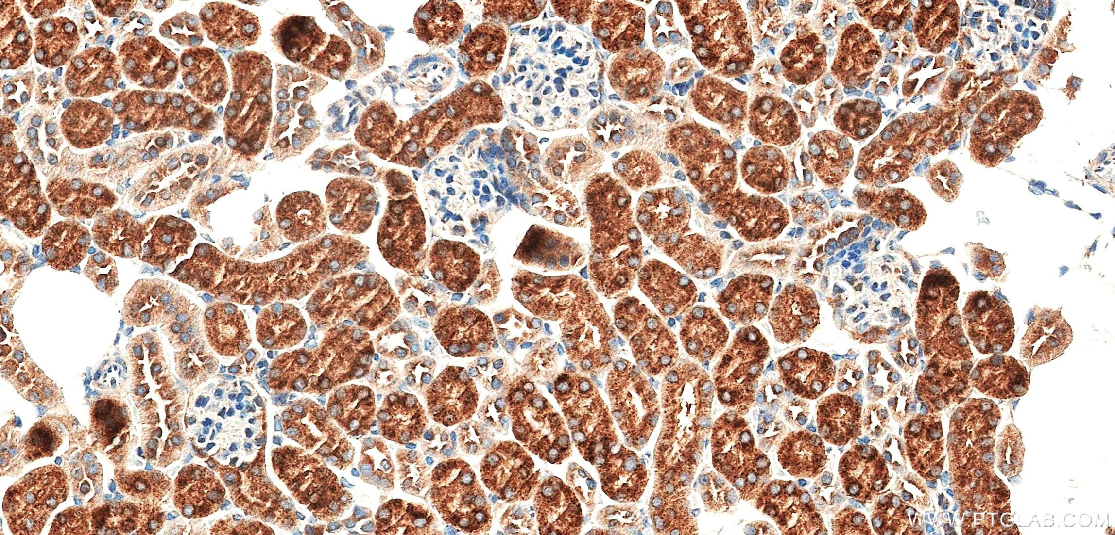 Immunohistochemistry (IHC) staining of mouse kidney tissue using ACOX1 Recombinant monoclonal antibody (83731-2-RR)