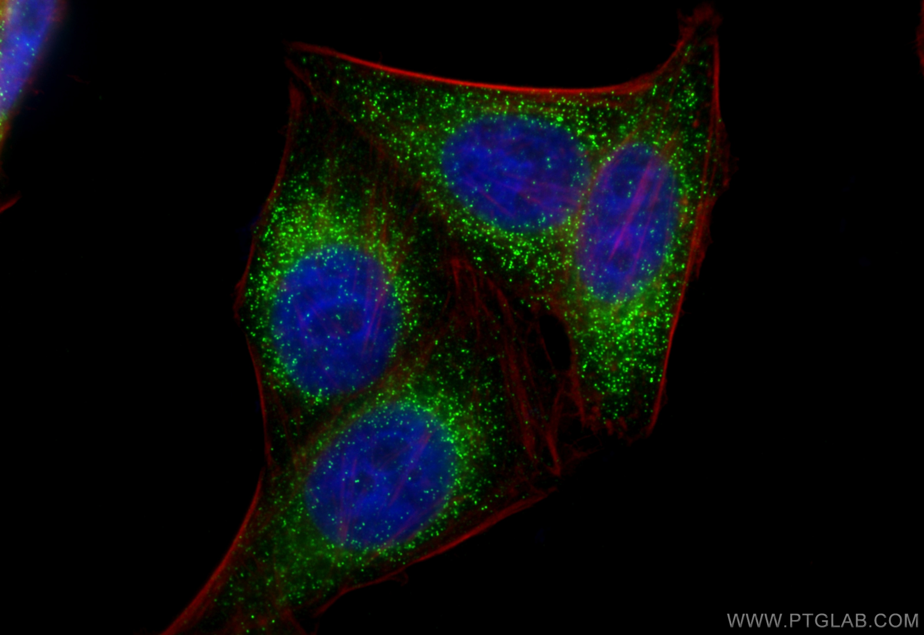 Immunofluorescent analysis of (4% PFA) fixed HepG2 cells using AOX antibody (RMX00007) at dilution of 1:200 and Multi-rAb CoraLite ® Plus 488-Goat Anti-Rabbit Recombinant Secondary Antibody (H+L) (RGAR002), CL594-phalloidin (red).