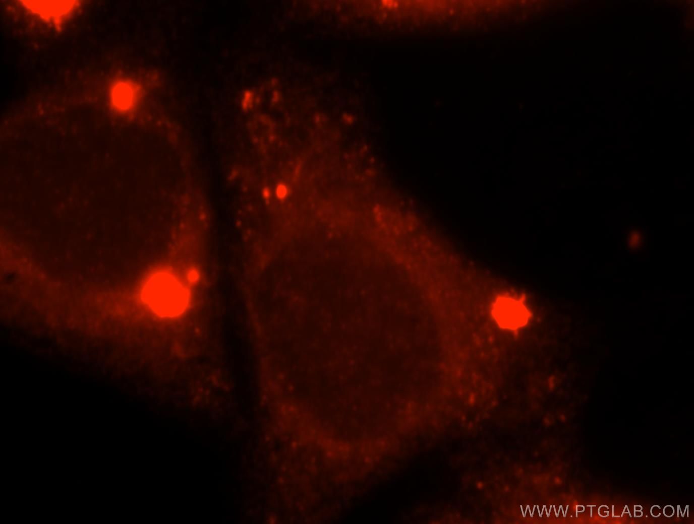Immunofluorescence (IF) / fluorescent staining of HepG2 cells using ACOX2 Polyclonal antibody (17571-1-AP)