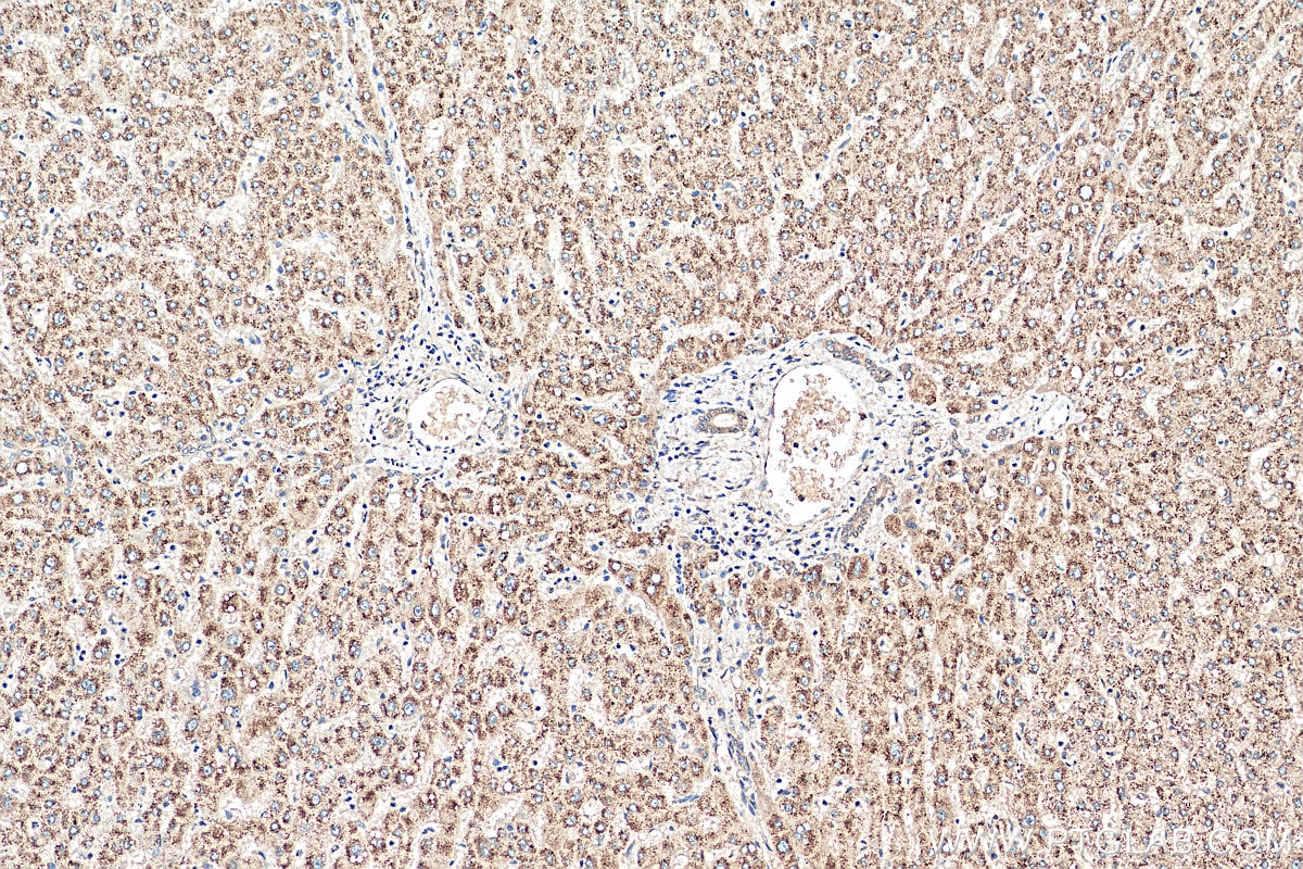 Immunohistochemistry (IHC) staining of human liver tissue using ACOX2 Polyclonal antibody (17571-1-AP)