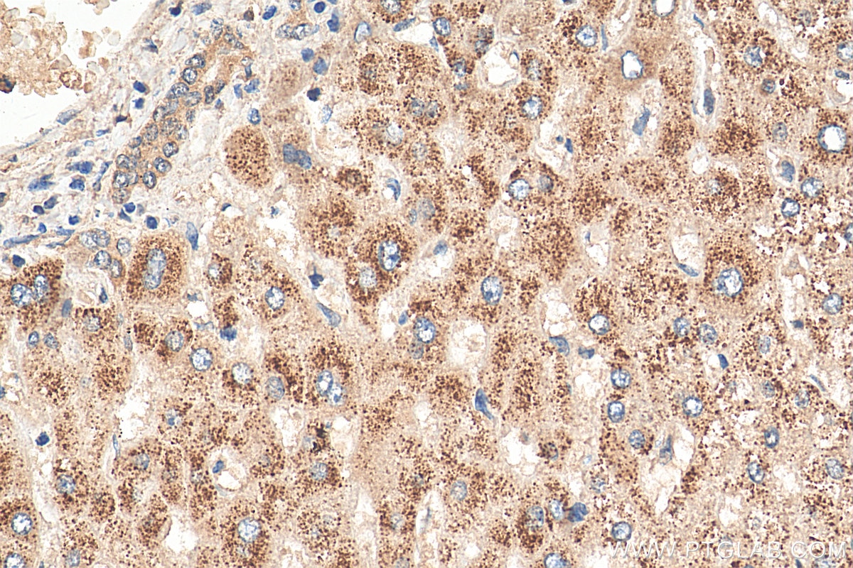 Immunohistochemistry (IHC) staining of human liver tissue using ACOX2 Polyclonal antibody (17571-1-AP)