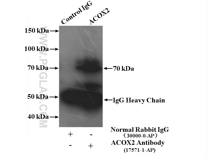 Immunoprecipitation (IP) experiment of mouse liver tissue using ACOX2 Polyclonal antibody (17571-1-AP)