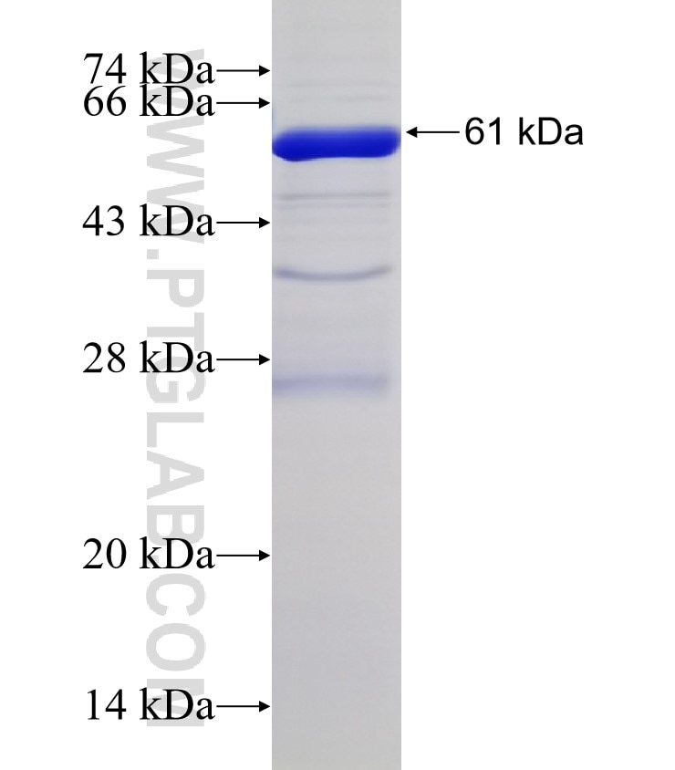 ACOX2 fusion protein Ag11778 SDS-PAGE