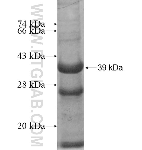 ACOX2 fusion protein Ag11798 SDS-PAGE
