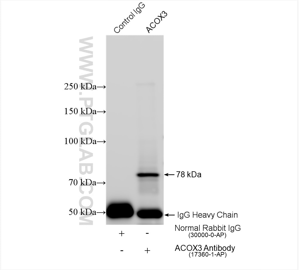 Immunoprecipitation (IP) experiment of A549 cells using ACOX3 Polyclonal antibody (17360-1-AP)