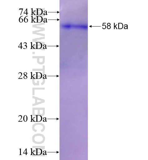 ACOX3 fusion protein Ag10553 SDS-PAGE