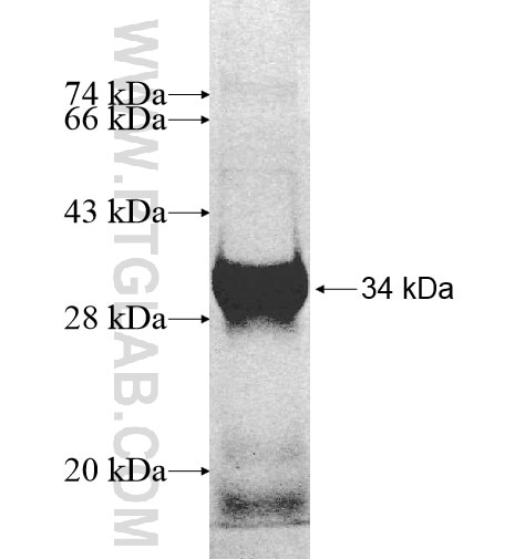 ACOX3 fusion protein Ag10653 SDS-PAGE