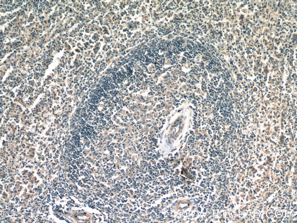 IHC staining of human spleen using 23366-1-AP