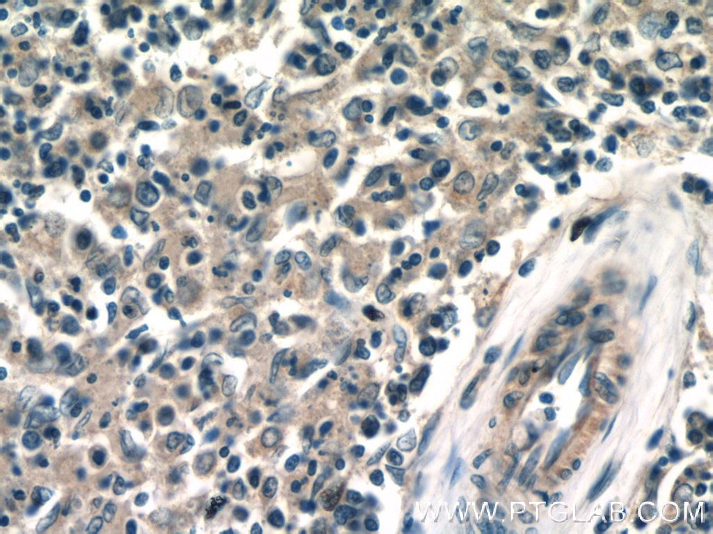 Immunohistochemistry (IHC) staining of human spleen tissue using ACOXL Polyclonal antibody (23366-1-AP)