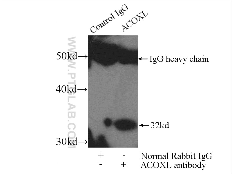 Immunoprecipitation (IP) experiment of K-562 cells using ACOXL Polyclonal antibody (23366-1-AP)