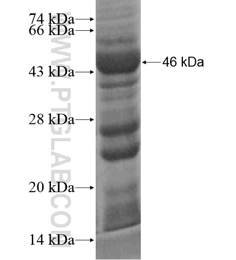ACOXL fusion protein Ag18625 SDS-PAGE