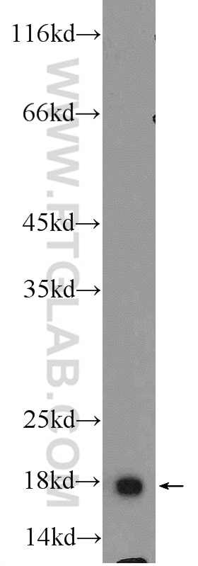 Western Blot (WB) analysis of 4T1 cells using ACP1 Polyclonal antibody (22214-1-AP)