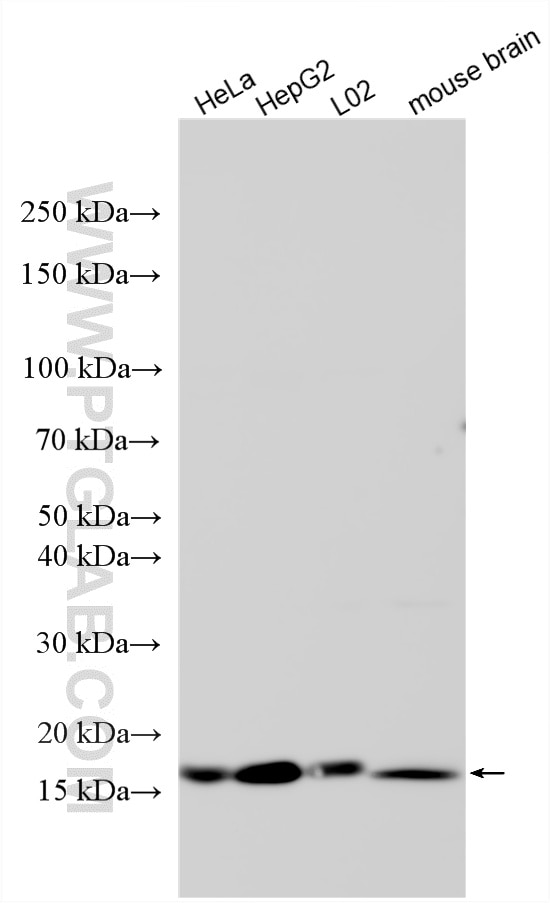 Various lysates were subjected to SDS PAGE followed by western blot with 22214-1-AP (ACP1 antibody) at dilution of 1:2000 incubated at room temperature for 1.5 hours. Western Blot (WB) analysis of various lysates using ACP1 Polyclonal antibody (22214-1-AP)