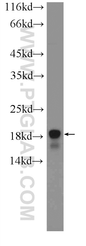 Western Blot (WB) analysis of mouse brain tissue using ACP1 Polyclonal antibody (22214-1-AP)