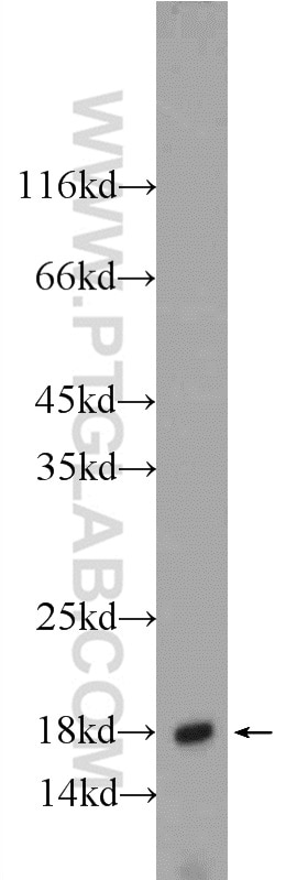 Western Blot (WB) analysis of mouse brain tissue using ACP1 Polyclonal antibody (22214-1-AP)