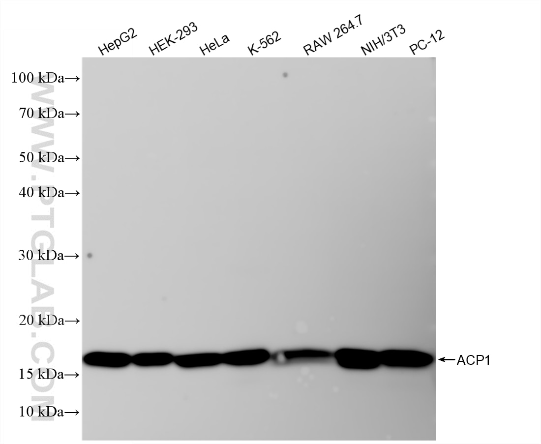 Western Blot (WB) analysis of various lysates using ACP1 Recombinant monoclonal antibody (86817-1-RR)
