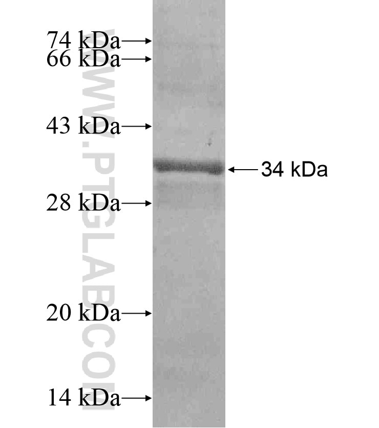ACP1 fusion protein Ag17539 SDS-PAGE