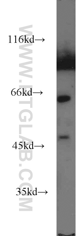 WB analysis of mouse kidney using 15236-1-AP