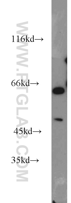 Western Blot (WB) analysis of mouse kidney tissue using ACP2 Polyclonal antibody (15236-1-AP)