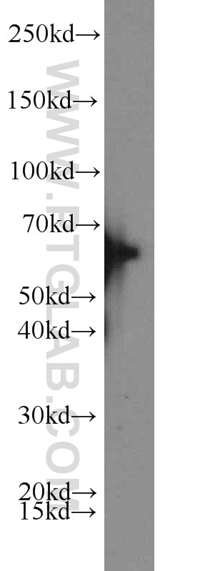 Western Blot (WB) analysis of HL-60 cells using ACP2 Polyclonal antibody (15236-1-AP)