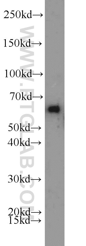 Western Blot (WB) analysis of HL-60 cells using ACP2 Polyclonal antibody (15236-1-AP)