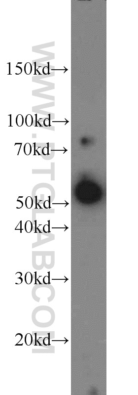 WB analysis of mouse brain using 15236-1-AP